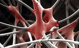 Textile Innovations – Grilon Binder Fibers for Functional Textiles